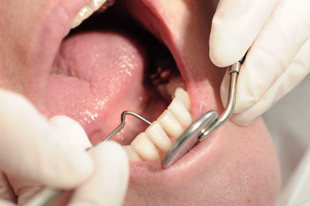 Brutta storia Ha iniziato con un mal di denti innocuo - Il giovane padre della famiglia muore per infezione dentale / Notizie di salute