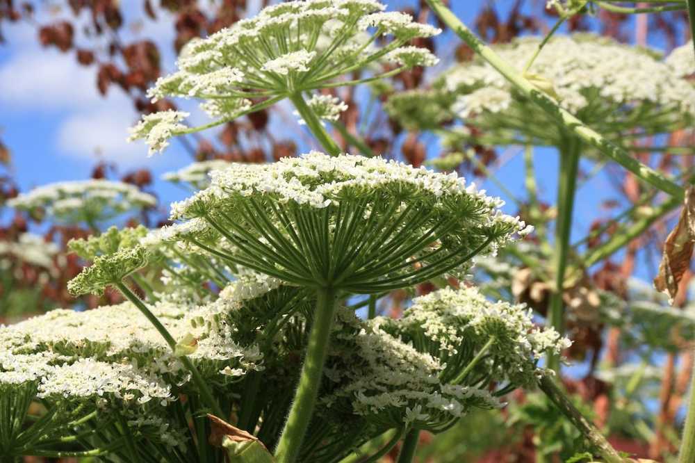 Douleur après le jardinage La griffe de l'ours peut causer des brûlures et des éruptions cutanées / Nouvelles sur la santé