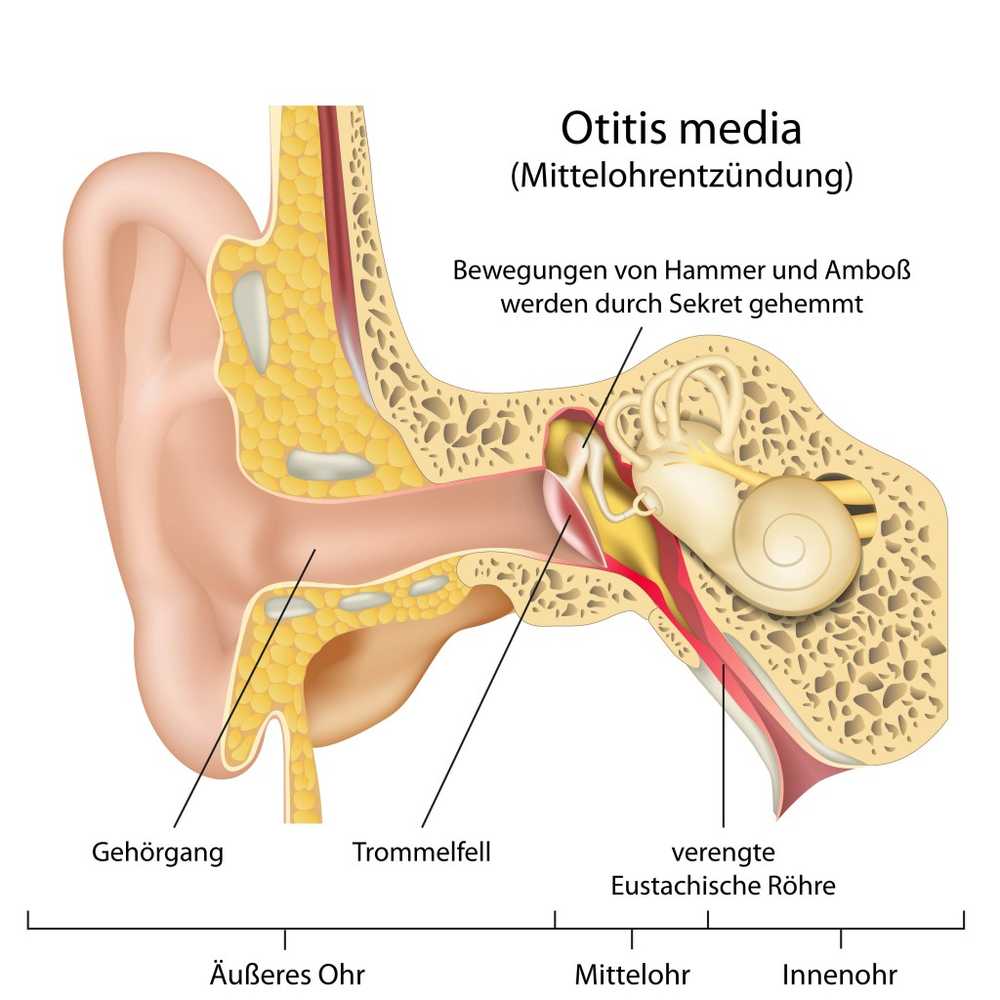 Painful hydropathy Vaseline and cotton wool can help the ear / Health News