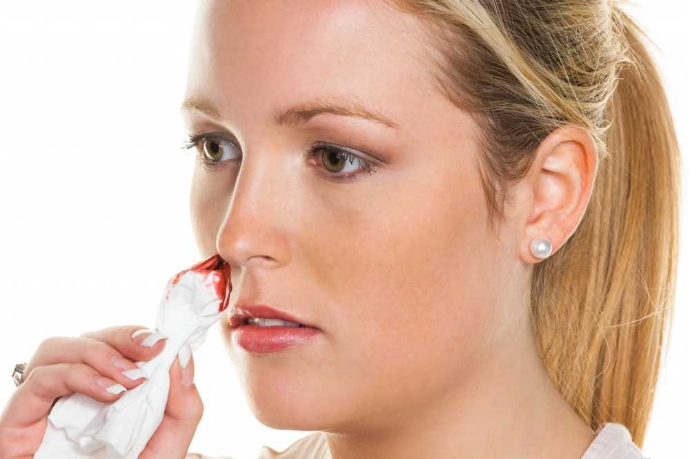 Quick help with nosebleeds / Health News