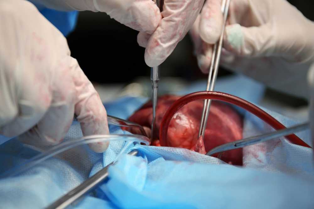 Pig hearts transplanted into baboons - is the transplantation in humans now? / Health News