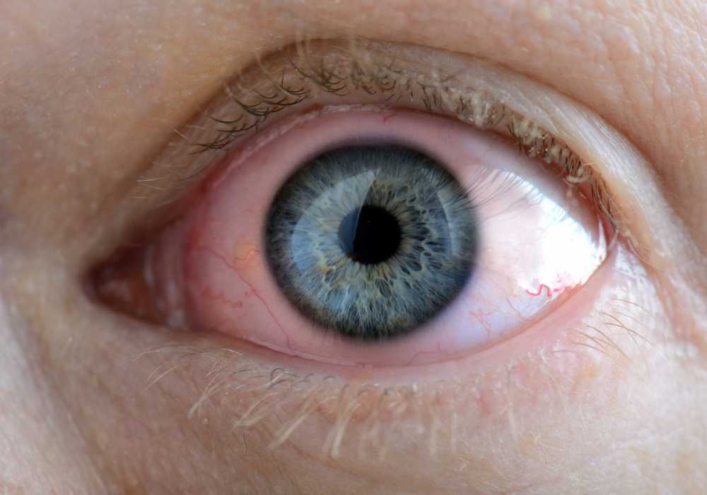 Swimming Pool Where do the red eyes come from? By urine or rather chlorine? / Health News