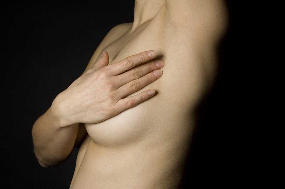 Statins can prevent the metastasis of breast cancer