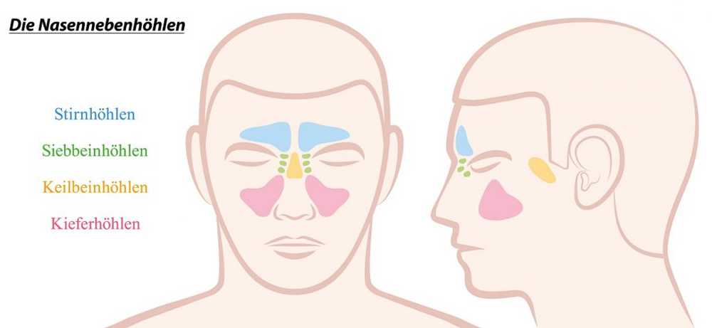 Sinusitis - Symptoms, Treatment and Home Remedies