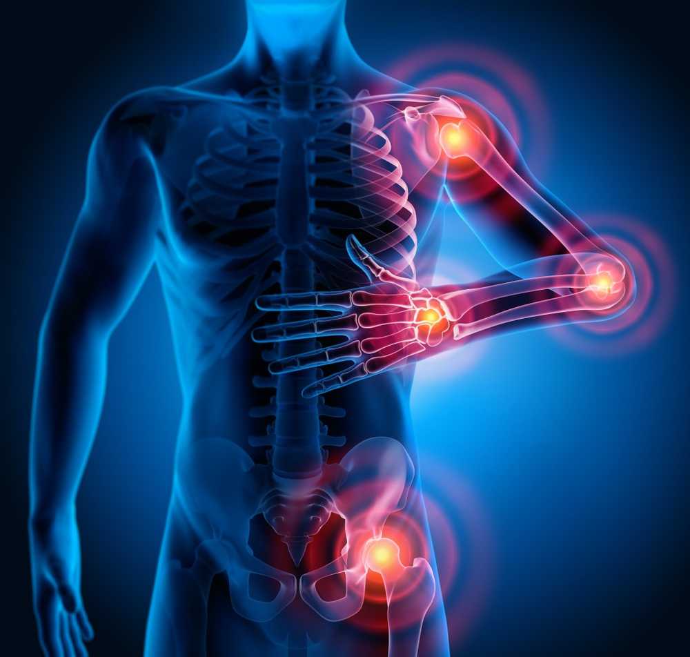 Testul suplimentelor alimentare pentru articulații accelerează creșterea melanomului / Știri despre sănătate