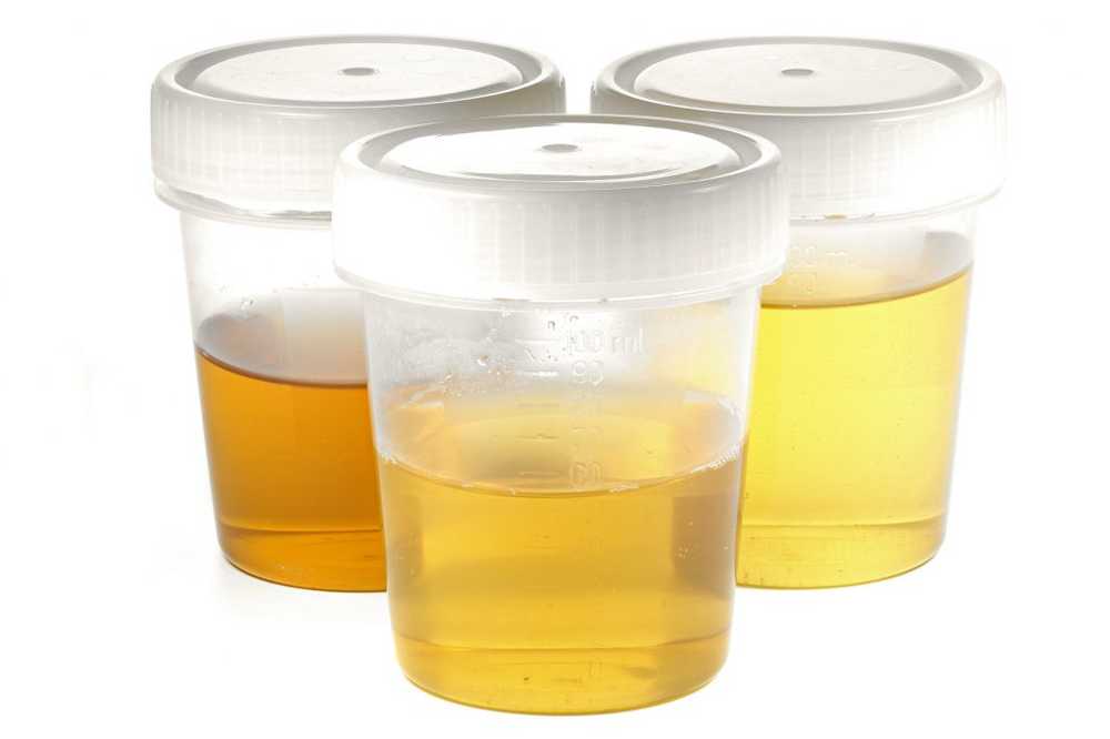 Scuro o luminoso Con l'urina è possibile controllare lo stato di salute / Notizie di salute