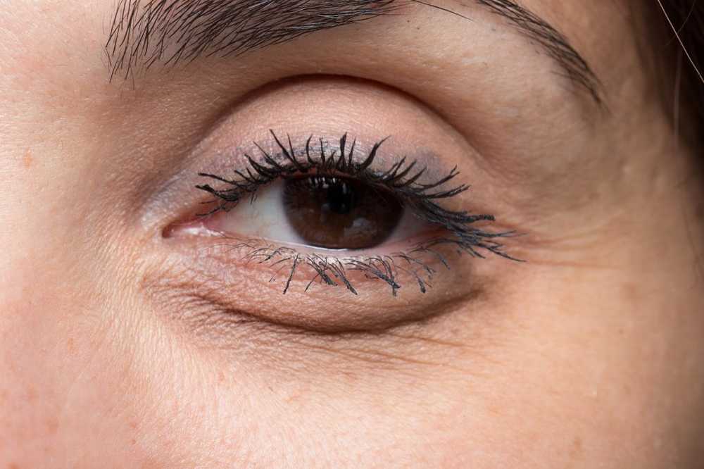 Skyte øyne - årsaker, sykdommer og behandling