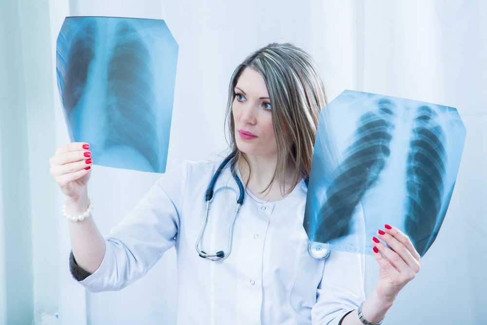 Avoidable tragedy Lung cancer is still underestimated / Health News