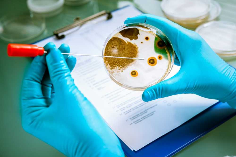 Many unknown but dangerous bacteria in the kitchen / Health News