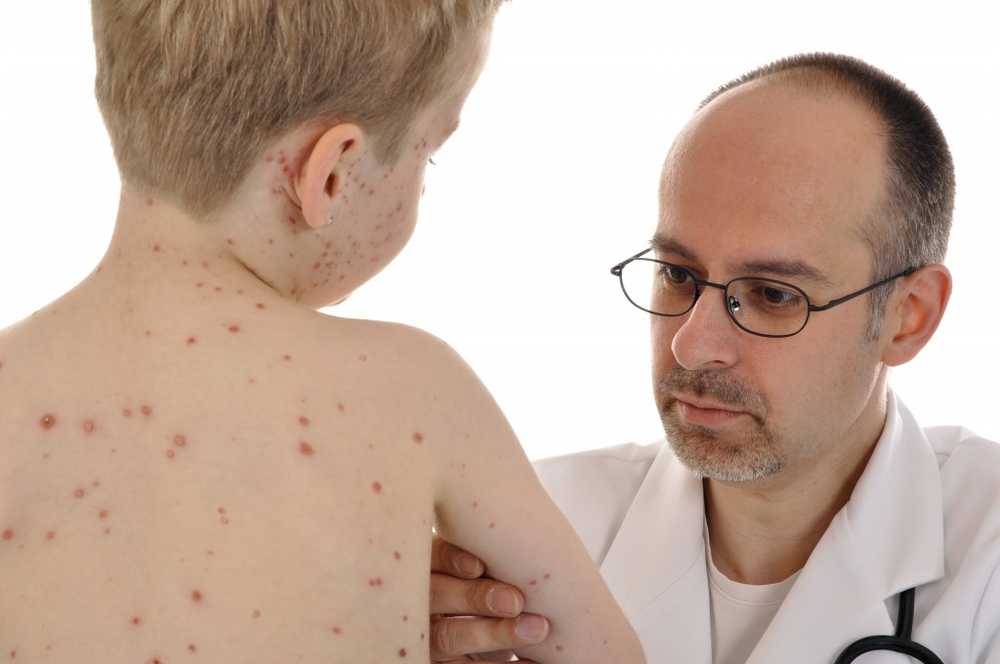 WHO warning measles infections rose sharply / Health News