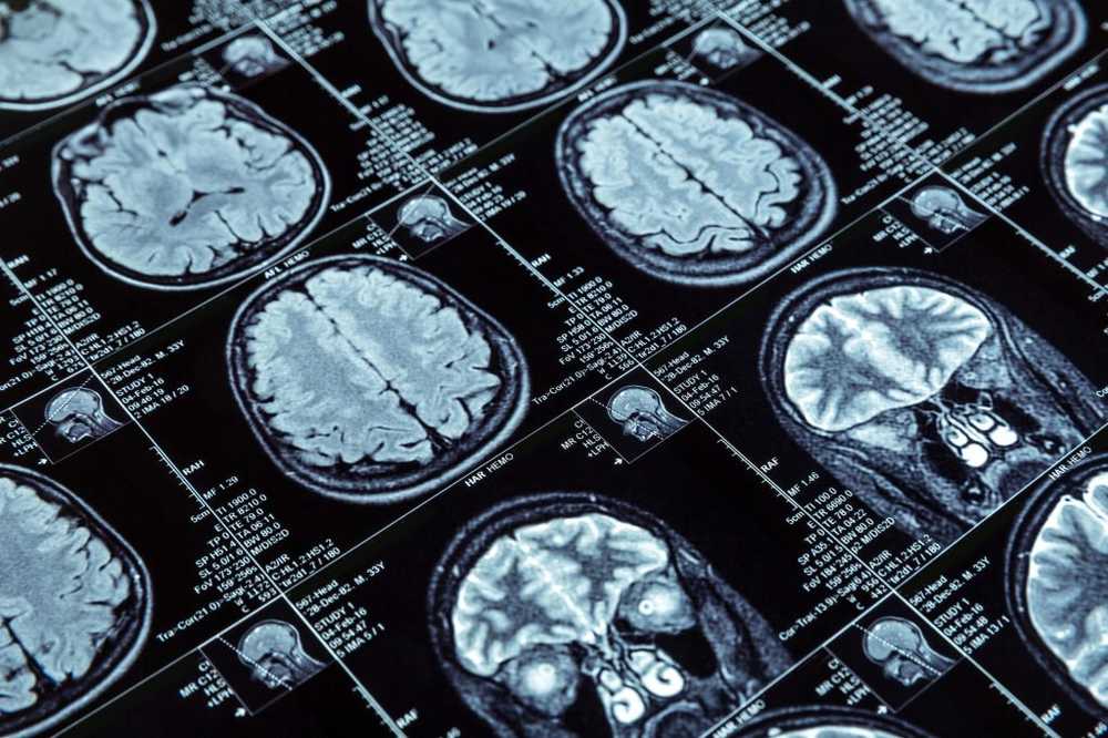 La propensione all'utilizzo di droghe è determinata dall'attività cerebrale? / Notizie di salute