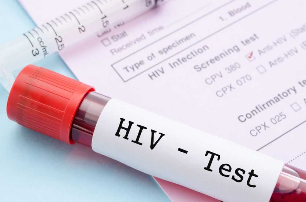 Number of new HIV infections does not decline / Health News