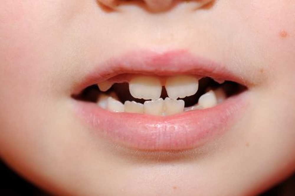 Tandarts Nog mooiere tanden in ongeveer een uur / Gezondheid nieuws