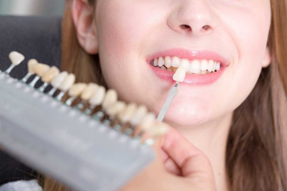 Carie dentaria Nuovi denti dopo circa un'ora? / Notizie di salute