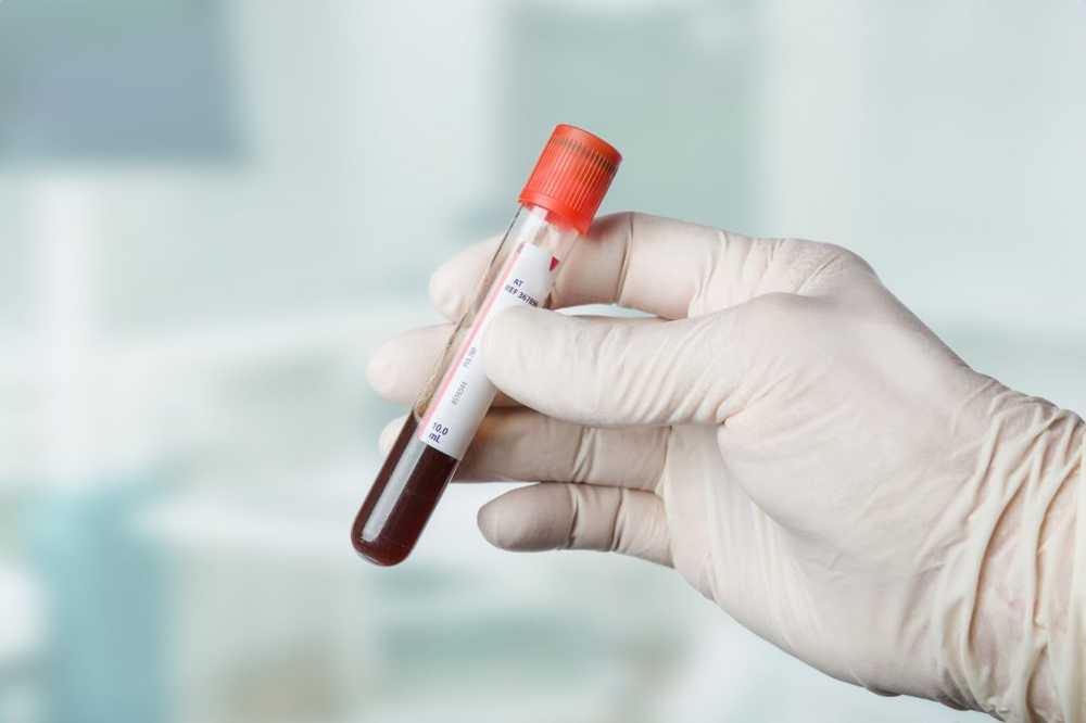 Baanbrekende diagnostiek Identificeer en controleer nu kankers via een bloedtest / Gezondheid nieuws