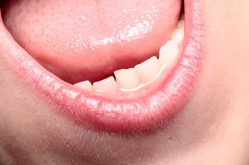 Tongue coverings Hva sier tungen om vår helse?