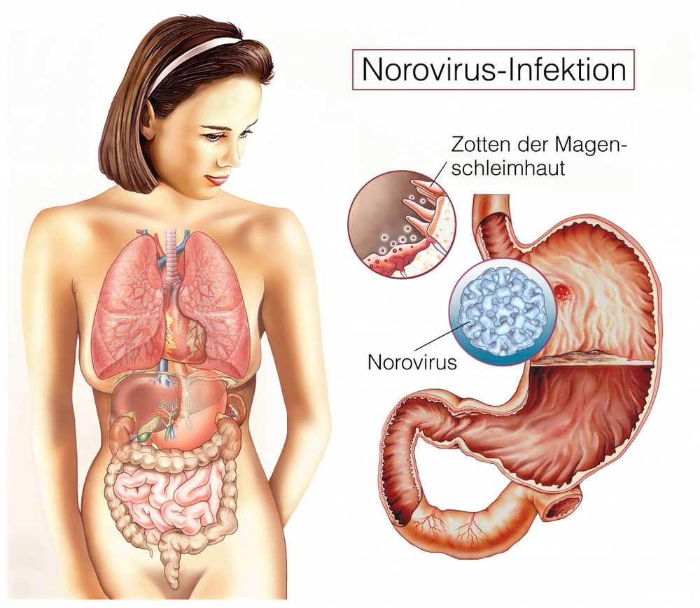 Acute abdominal pain / 