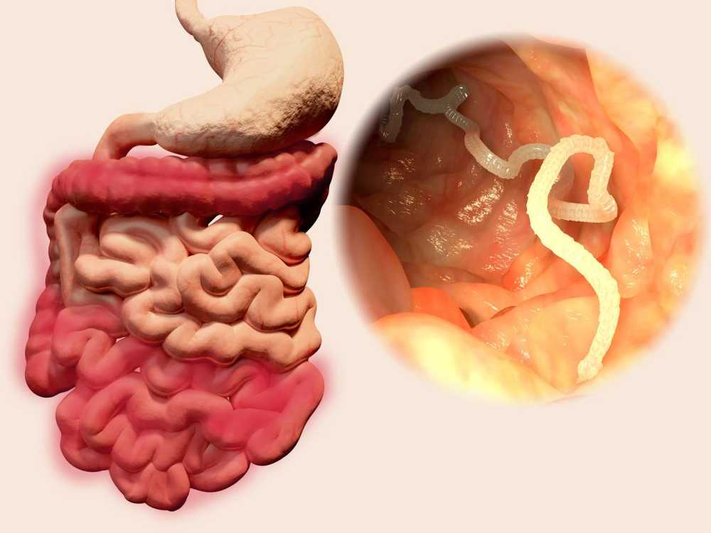 Ténia augmenter le risque d'allergie en éradiquant les vers / Nouvelles sur la santé