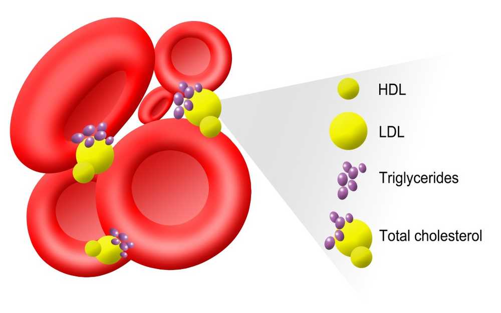 La qualité est cruciale dans le cholestérol HDL / Nouvelles sur la santé