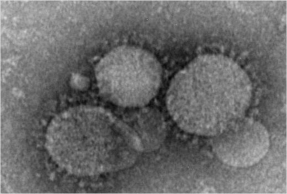 Redan sex dödsfall i Sydkorea av Mers virus / Hälsa nyheter