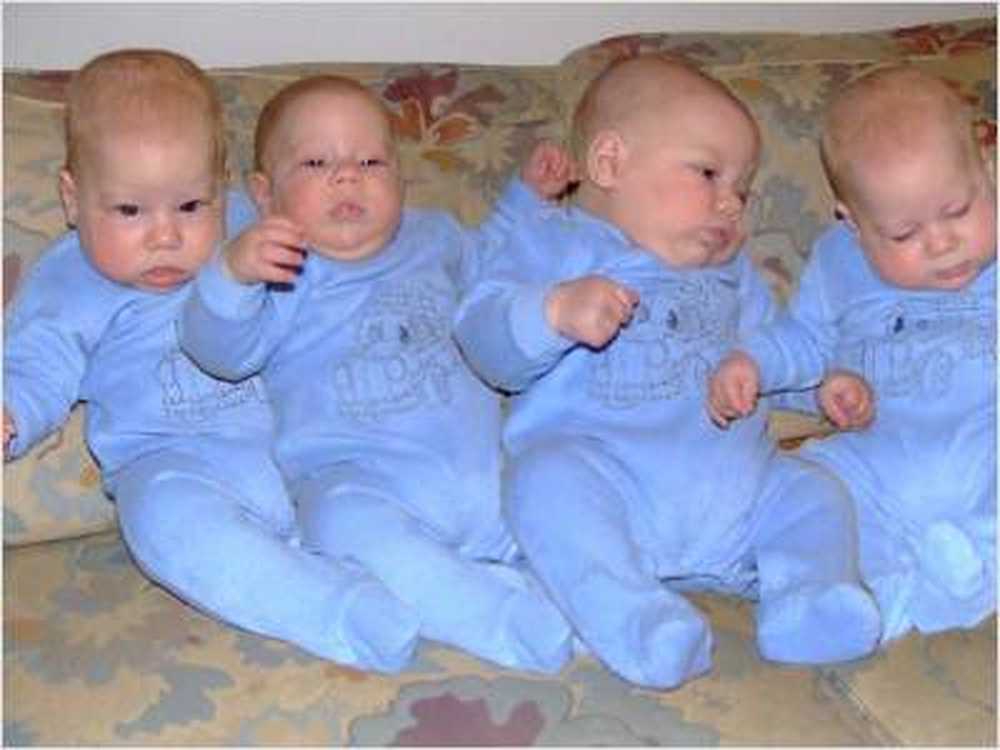 Chances of survival? 65-year-old gets quadruplets / Health News