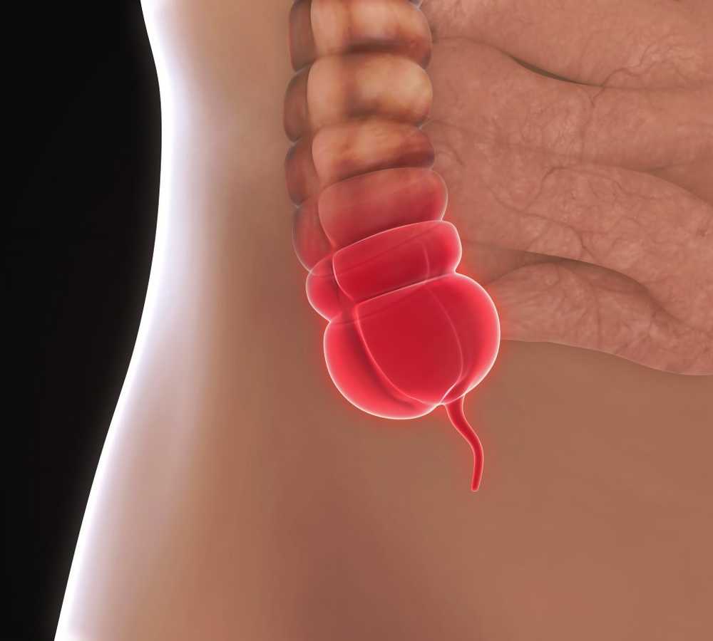 Appendicitis Antibiotics could often prevent surgery / Health News