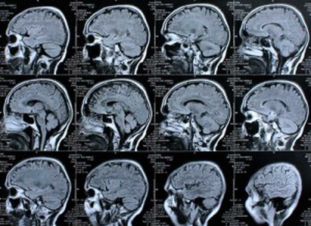 Informe de salud DAK El dopaje cerebral en el trabajo está aumentando / Noticias de salud