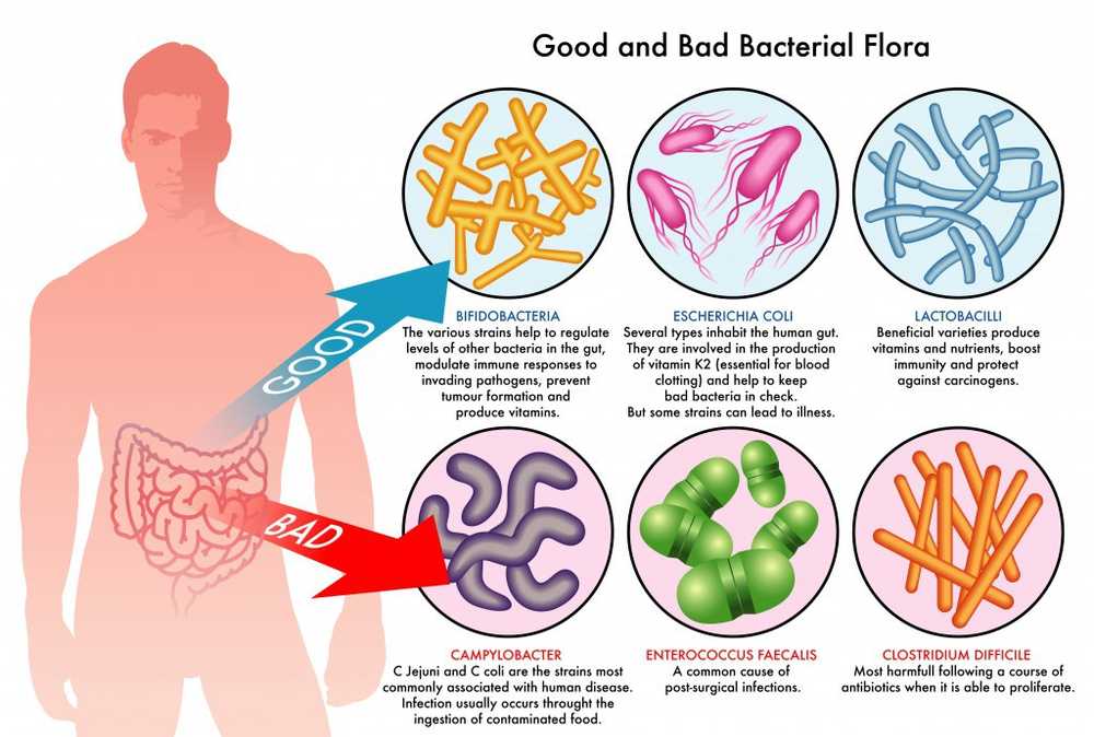 Intestinal flora refreshed Stool transplants help against severe diarrhea / Health News