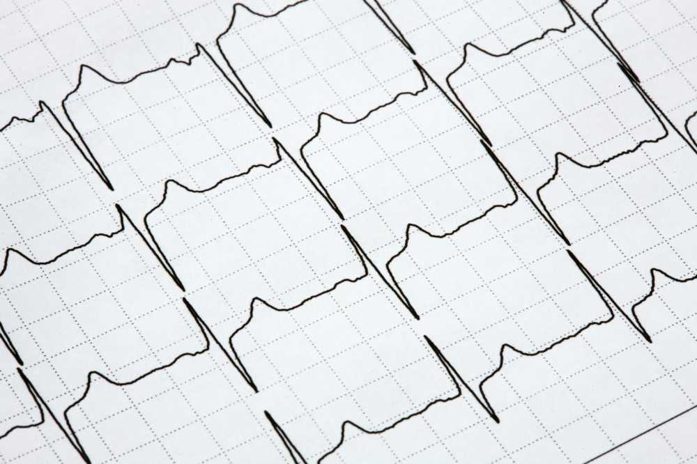 Diabetes medisin nyttig mot hjerteinfarkt og slag / Helse Nyheter