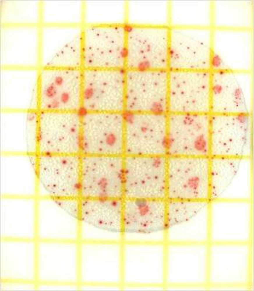 Fièvre Chikungunya Dominicaine / Nouvelles sur la santé