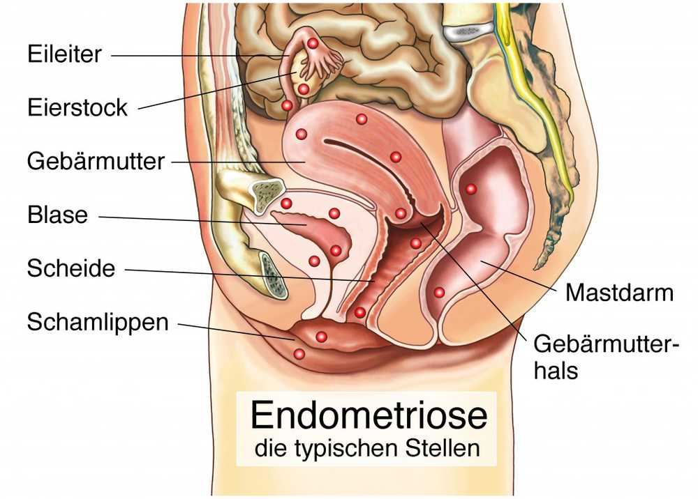 Ägglossning smärta hjälp och orsaker / symptom