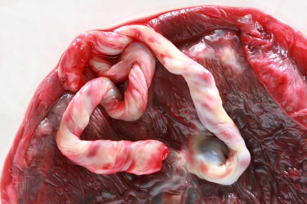 Eating your own placenta should not bring any health benefits / Health News