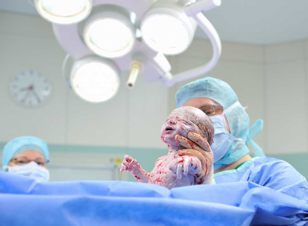 Almost every third child in Germany is born by caesarean section / Health News