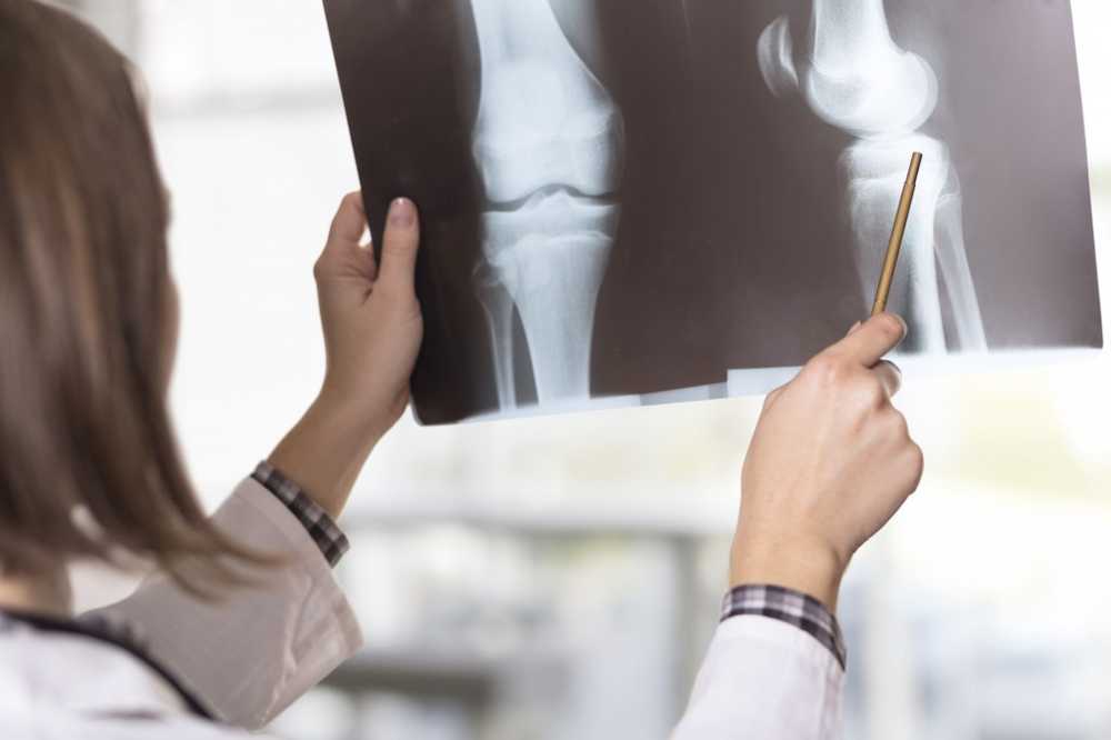 Fatal Misdiagnosis Doctors considered bone cancer a sports injury / Health News