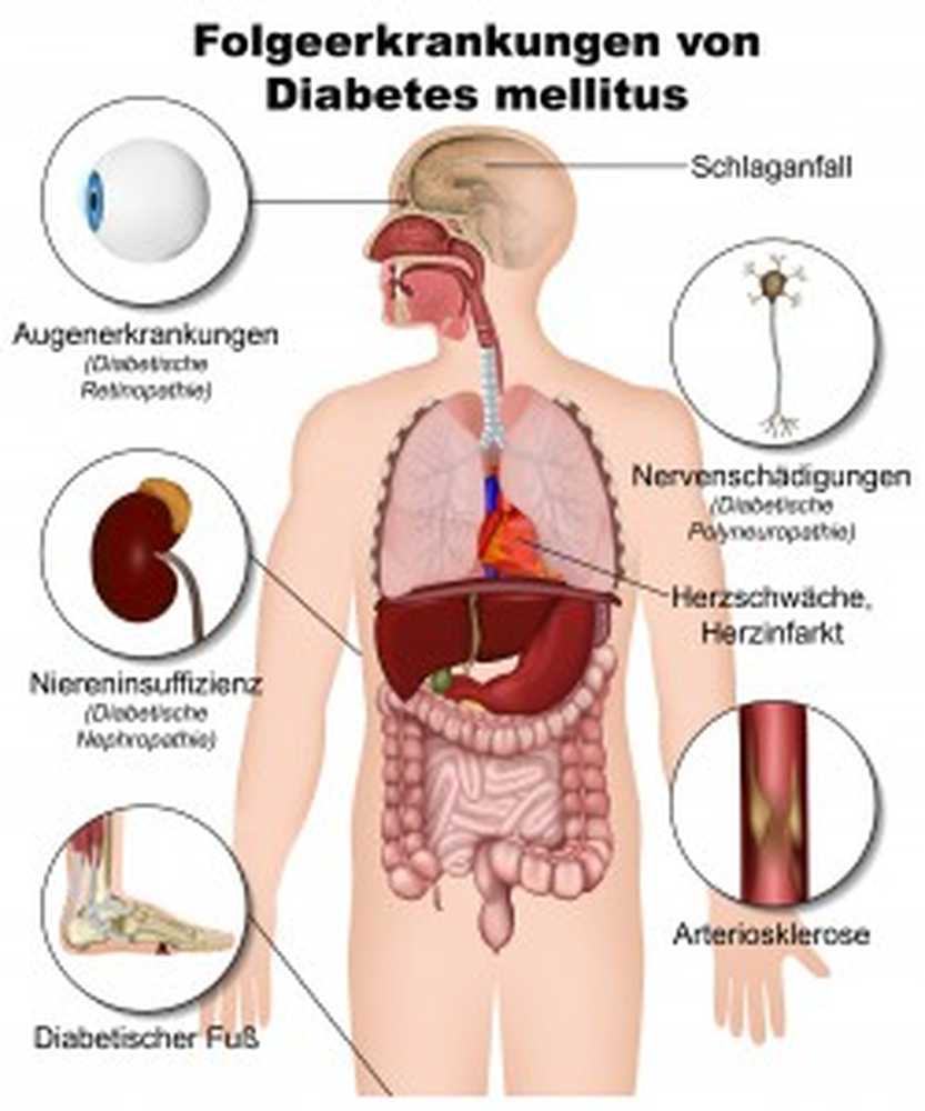 Prevenir complicaciones en la diabetes.