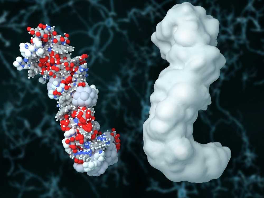 Las placas de los investigadores del Alzheimer protegen el cerebro de las infecciones. / Noticias de salud