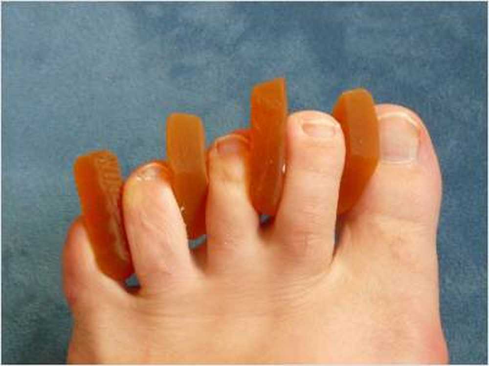 Chiropody Det här är hur nagelsvampen fixas / Hälsa nyheter