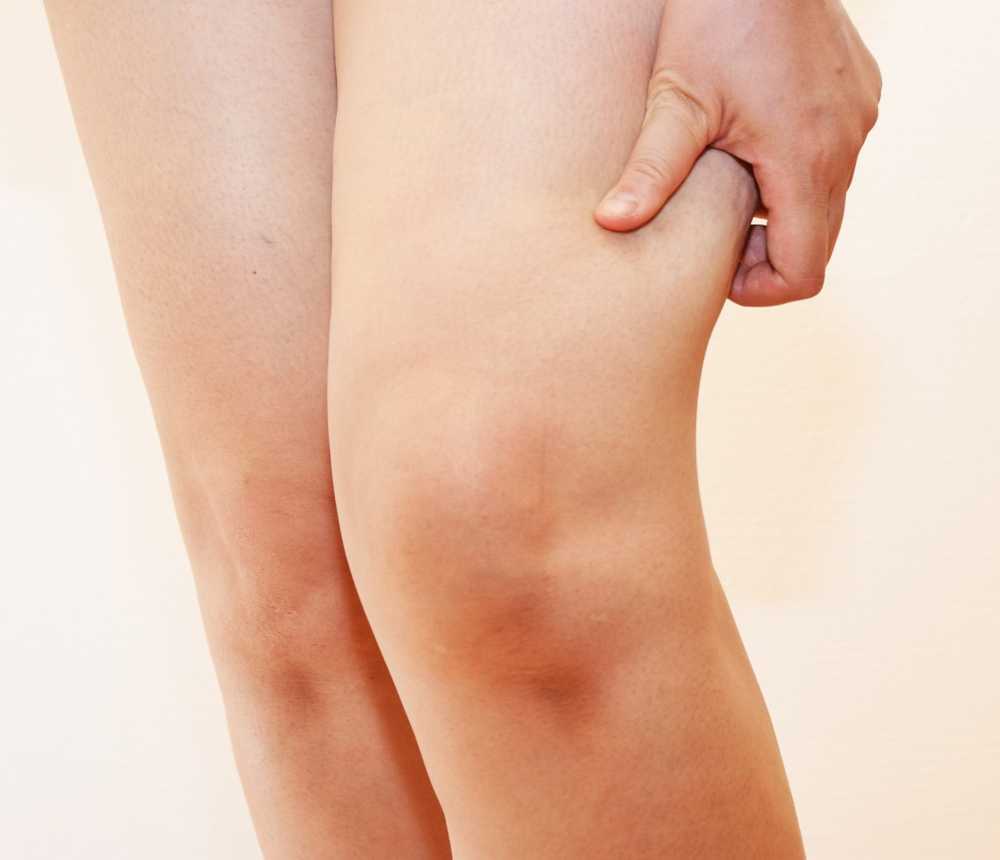 Swollen knee / symptoms