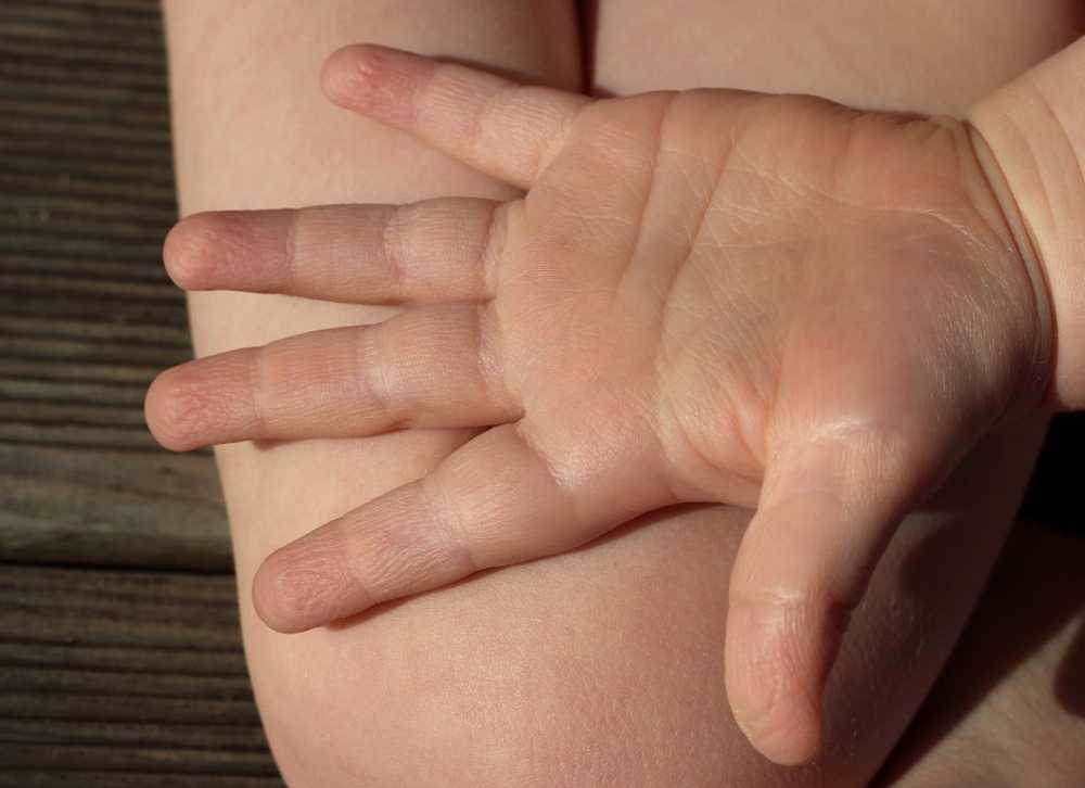 Health What to do with small splinters in the skin of children?