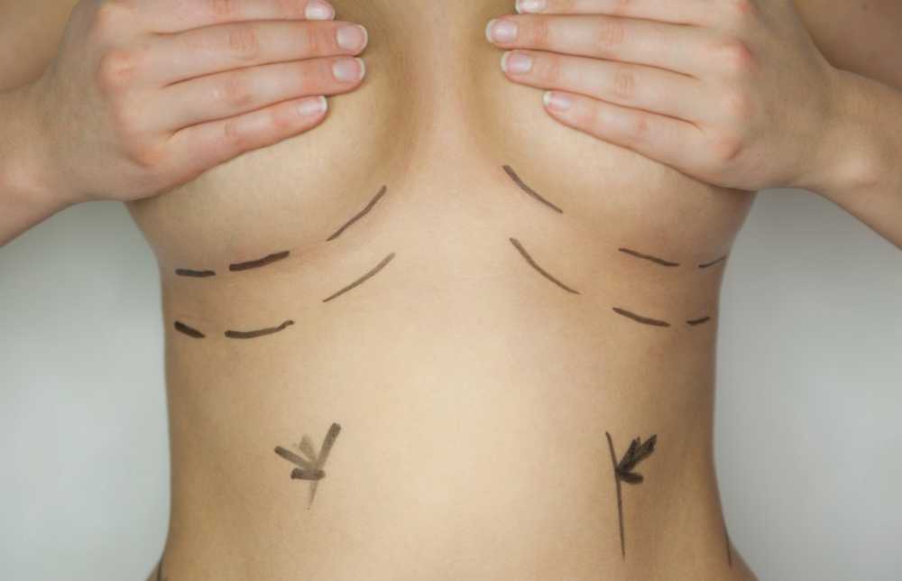 Big, taut and beautifully plump These are the trends of beauty surgery / Health News