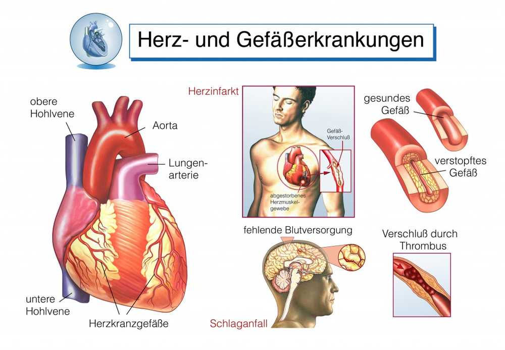 Heart stumbling causes and therapy