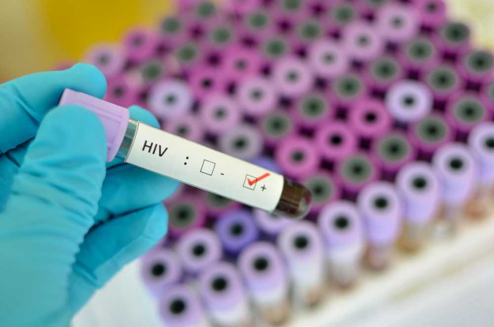 New HIV infections in Germany are not falling / Health News