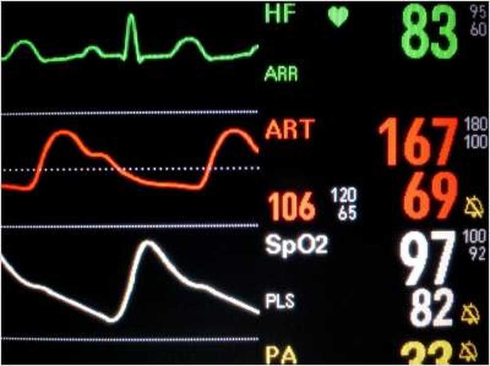 Hypertension So dramatic is hypertension / Health News