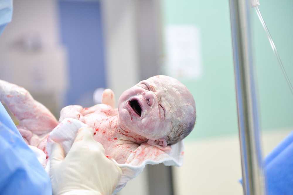 More and more cesarean births