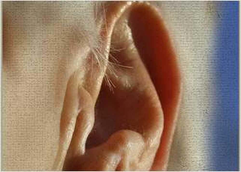 Inner ear prosthesis Listen again after decades / Health News