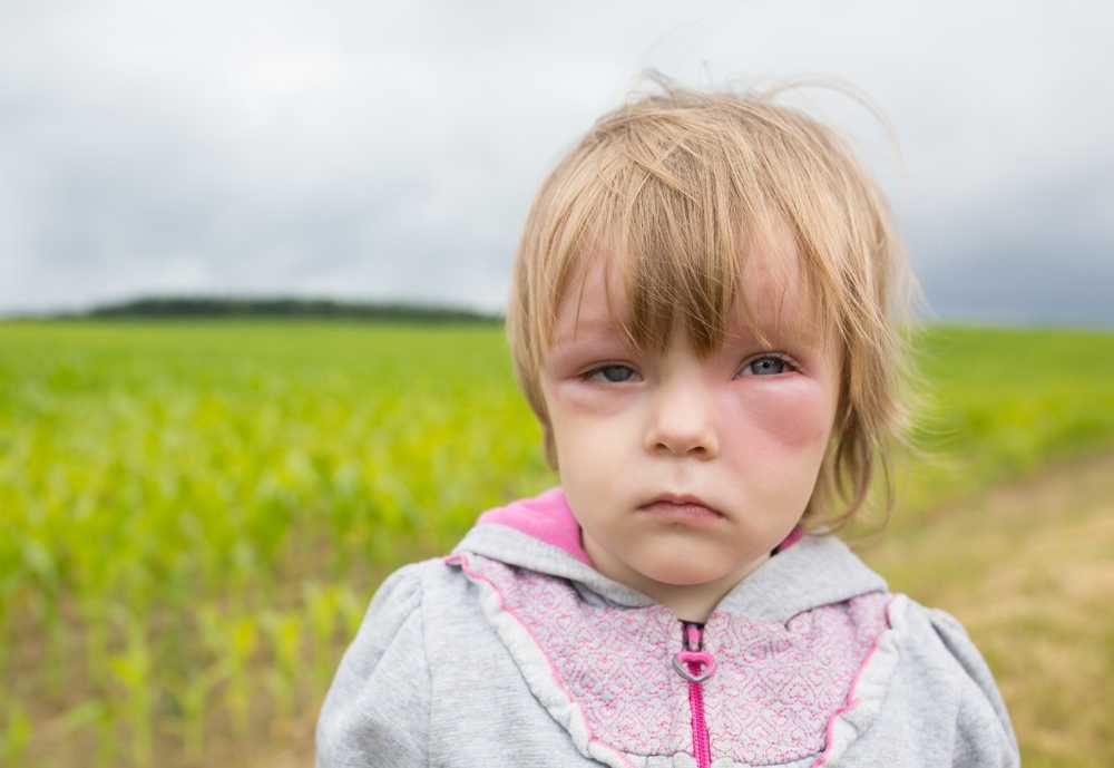 Children Frequent infections indicate allergies / Health News