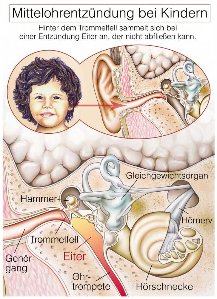 Children often middle ear infection due to cold / Health News