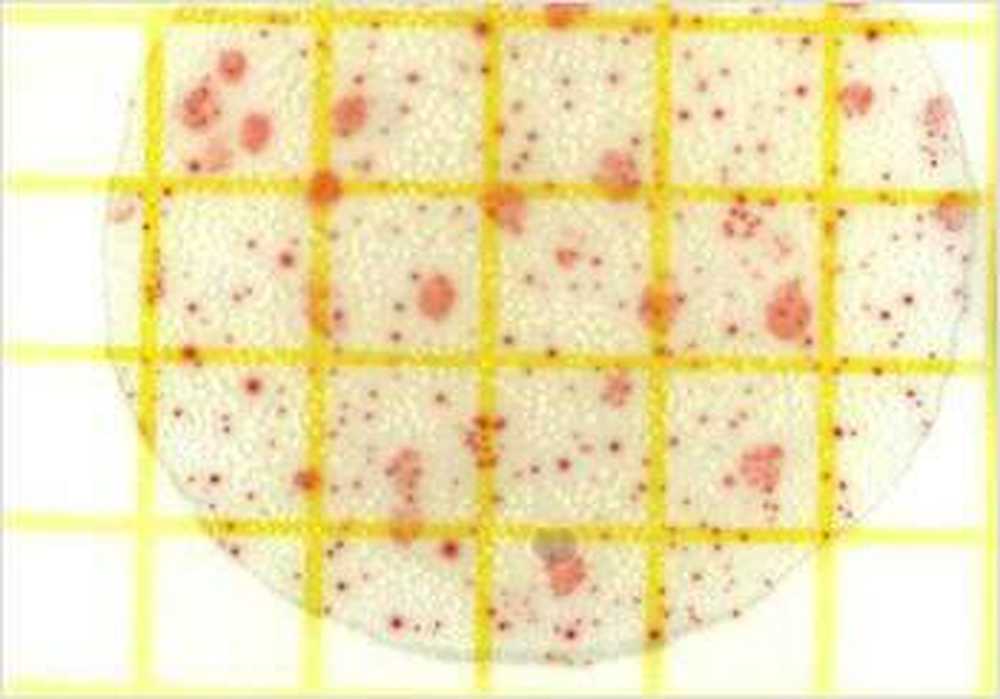 Les liposomes pourraient-ils remplacer les antibiotiques? / Nouvelles sur la santé