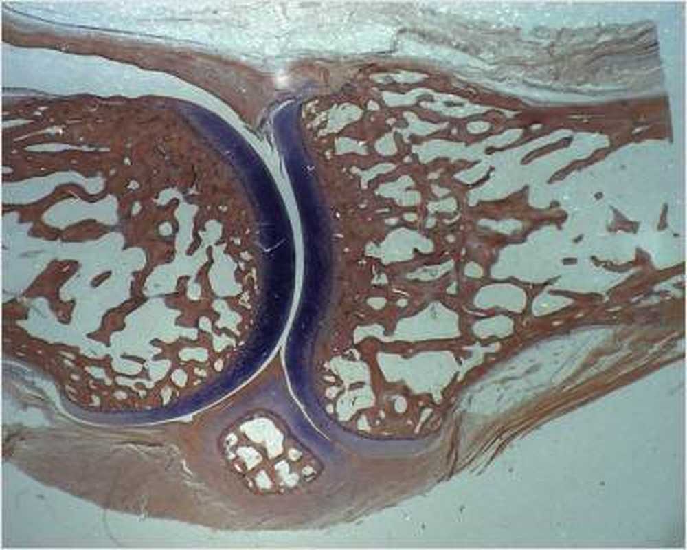 La residenza di studio del cancro può decidere sulla vita / Notizie di salute