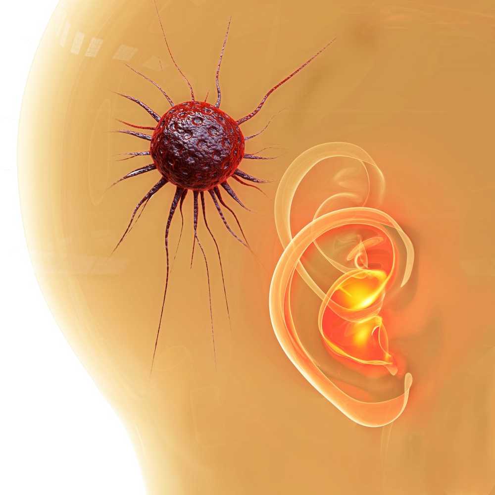 Kankertumoren in de hersenen Hersentumoren kunnen iedereen treffen / Gezondheid nieuws